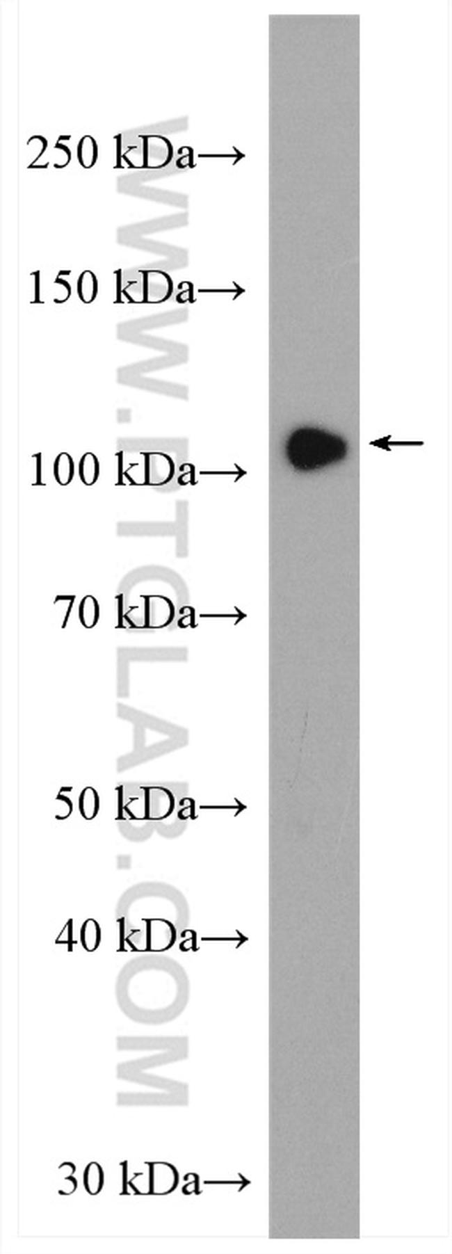 HIPK2 Antibody in Western Blot (WB)