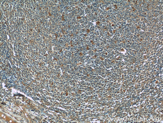 CCR7 Antibody in Immunohistochemistry (Paraffin) (IHC (P))