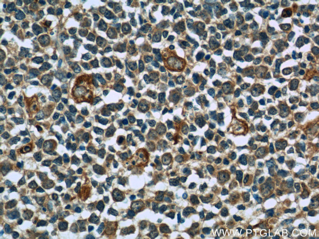 CCR7 Antibody in Immunohistochemistry (Paraffin) (IHC (P))