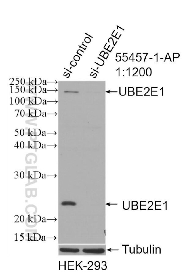 UBE2E1 Antibody in Western Blot (WB)