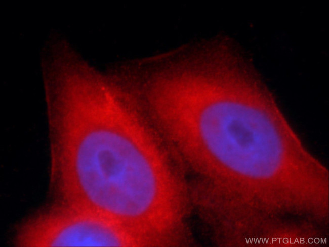 MMP20 Antibody in Immunocytochemistry (ICC/IF)