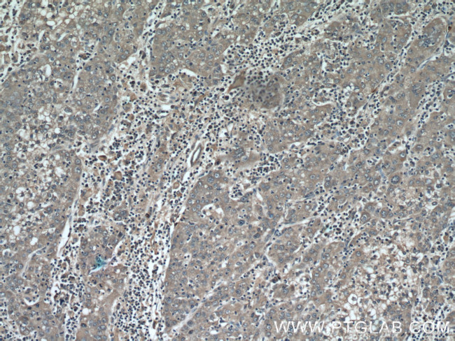 MMP20 Antibody in Immunohistochemistry (Paraffin) (IHC (P))