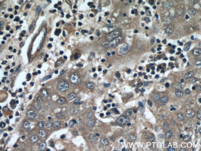 MMP20 Antibody in Immunohistochemistry (Paraffin) (IHC (P))