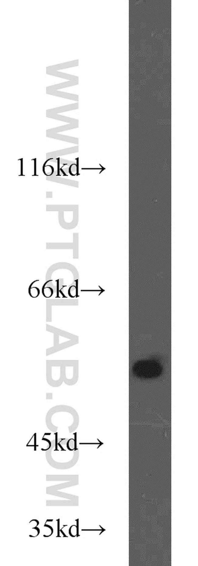 MMP20 Antibody in Western Blot (WB)