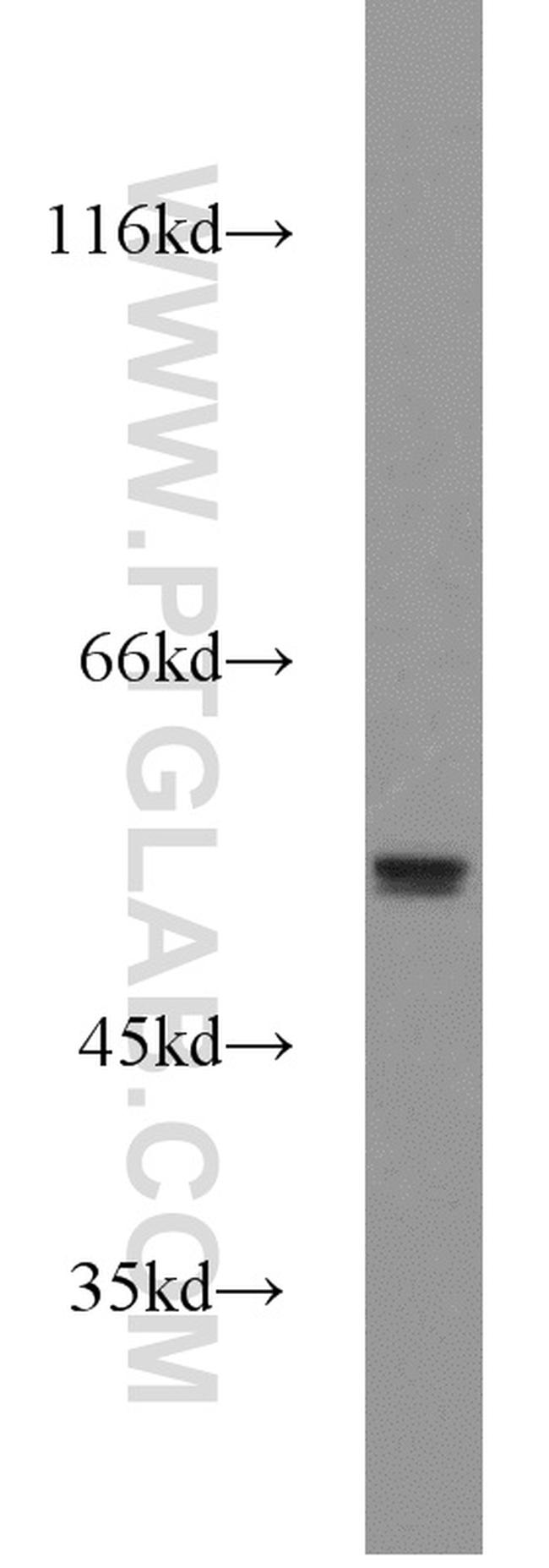 MMP20 Antibody in Western Blot (WB)