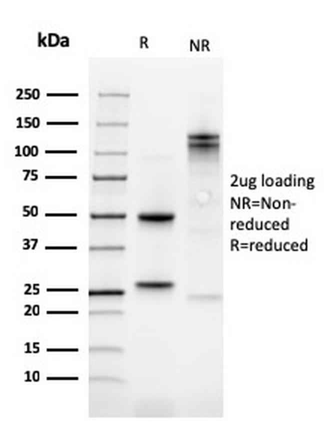 Kindlin-1/KIND1 Antibody in SDS-PAGE (SDS-PAGE)