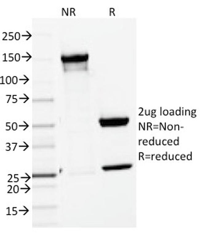 ENAH/MENA (Actin Regulator) Antibody in SDS-PAGE (SDS-PAGE)