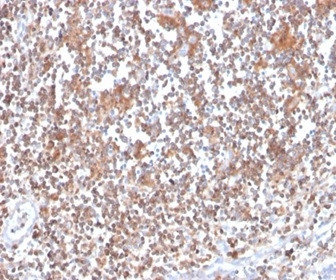 Protein Kinase C alpha/PRKCA Antibody in Immunohistochemistry (Paraffin) (IHC (P))