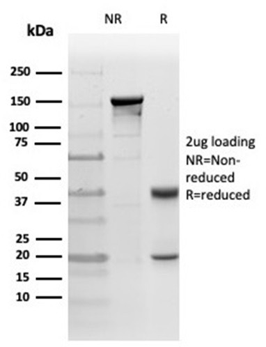 Protein Kinase C iota/lambda/PRKCI Antibody in Immunohistochemistry (Paraffin) (IHC (P))