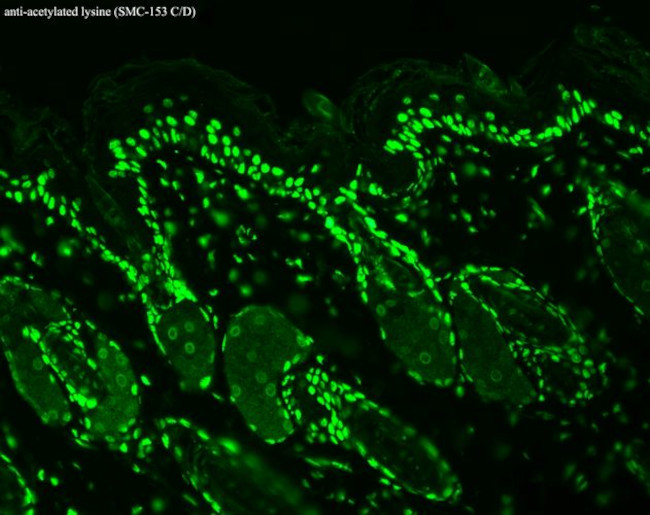 Acetylated Lysine Antibody in Immunohistochemistry (Paraffin) (IHC (P))