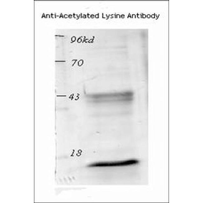 Acetylated Lysine Antibody in Western Blot (WB)