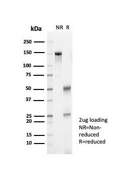 KLK7 (Kallikrein Related Peptidase 7) Antibody in SDS-PAGE (SDS-PAGE)