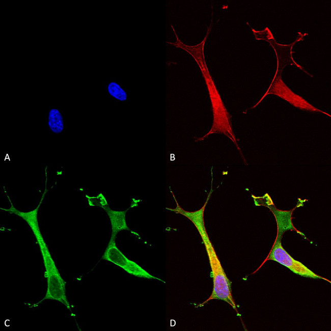 Copper-Transporting ATPase2 Antibody in Immunocytochemistry (ICC/IF)