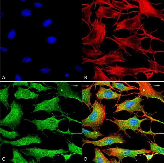 Copper-Transporting ATPase2 Antibody in Immunocytochemistry (ICC/IF)