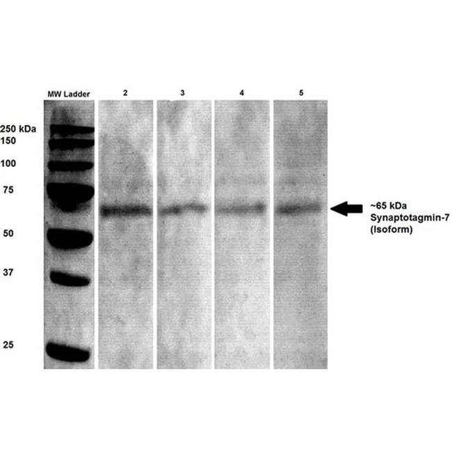 Synaptotagmin-7 Antibody in Western Blot (WB)