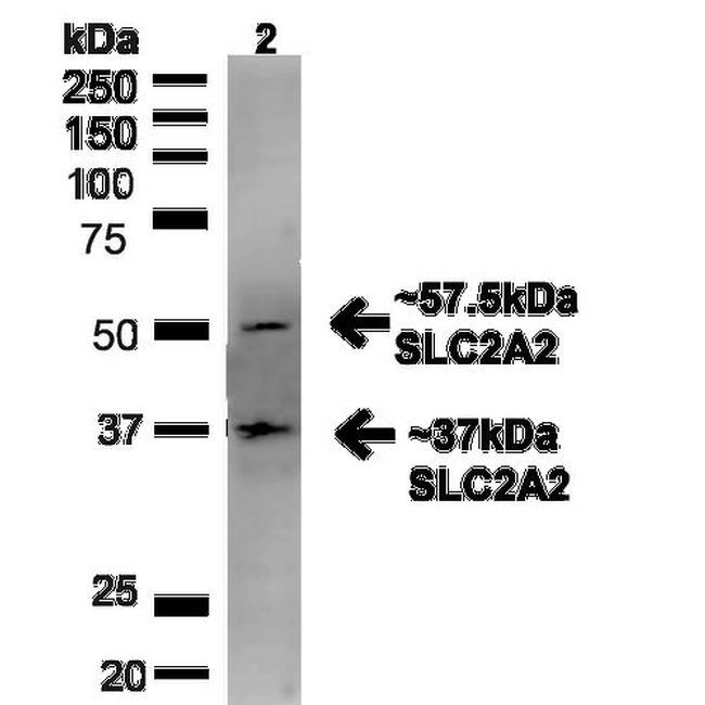 Glucose transporter 2 Antibody in Western Blot (WB)