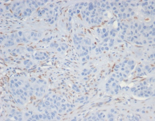 SALL-4 (Transcription Factor) Antibody in Immunohistochemistry (Paraffin) (IHC (P))