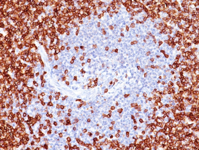 CD45RO Antibody in Immunohistochemistry (Paraffin) (IHC (P))