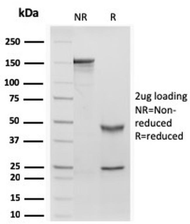Retinol Binding Protein-1 (RBP1) Antibody in SDS-PAGE (SDS-PAGE)