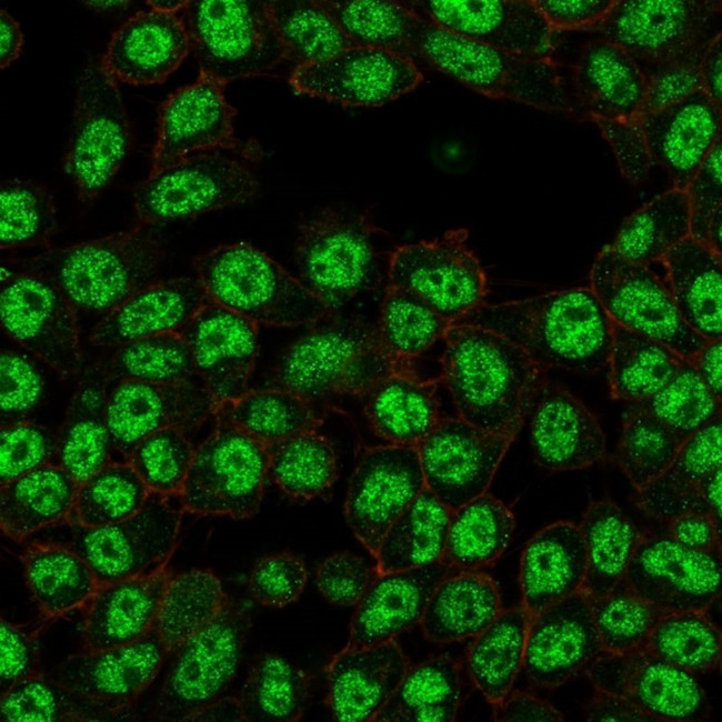 NF-kB p65/RELA Antibody in Immunocytochemistry (ICC/IF)