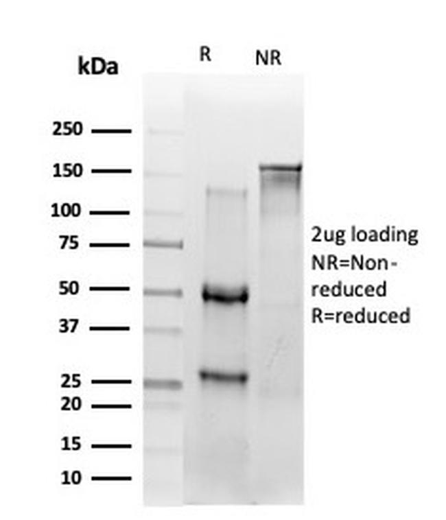 NF-kB p65/RELA Antibody in SDS-PAGE (SDS-PAGE)