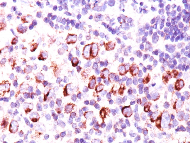 Bcl-X (Apoptosis Marker) Antibody in Immunohistochemistry (Paraffin) (IHC (P))