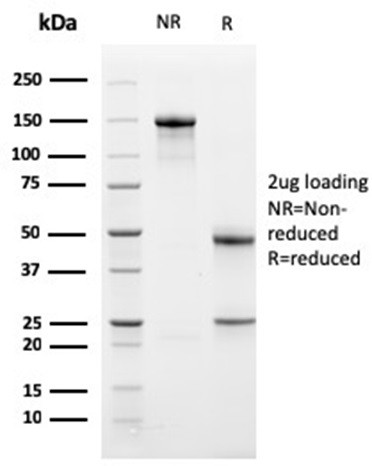 Bcl-X (Apoptosis Marker) Antibody in SDS-PAGE (SDS-PAGE)