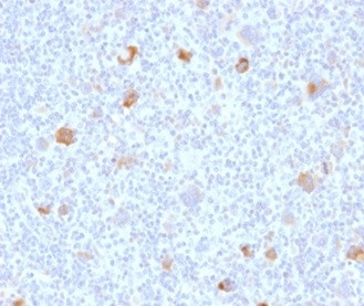 Bcl-X (Apoptosis Marker) Antibody in Immunohistochemistry (Paraffin) (IHC (P))