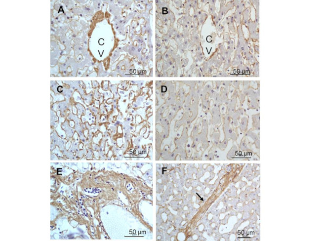 Collagen Type III Antibody in Immunohistochemistry (Paraffin) (IHC (P))