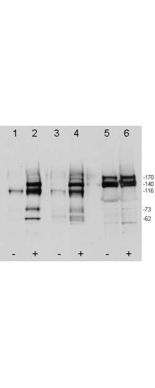 Phospho-c-Met (Tyr1349, Tyr1356) Antibody in Western Blot (WB)