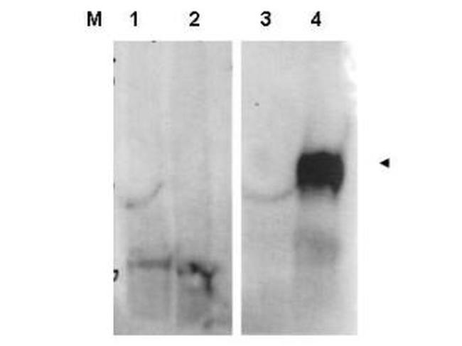 Fibroblast Activation Protein Antibody in Western Blot (WB)