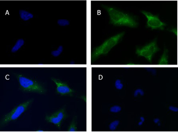 SQSTM1/p62 Polyclonal Antibody (600-401-HB8)