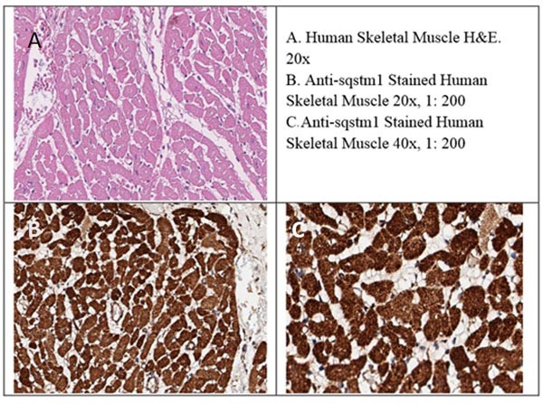 SQSTM1/p62 Polyclonal Antibody (600-401-HB8)