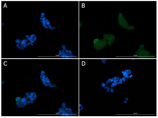 Ire1 Antibody in Immunocytochemistry (ICC/IF)