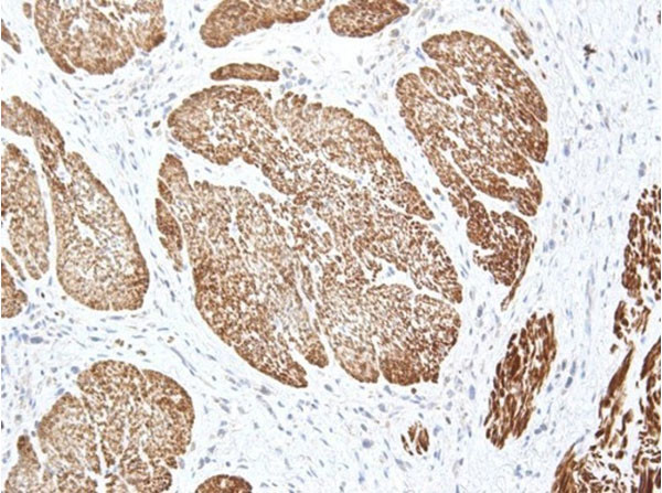 Ire1 Antibody in Immunohistochemistry (IHC)