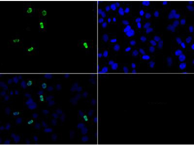 H3R3me2a Antibody in Immunocytochemistry (ICC/IF)