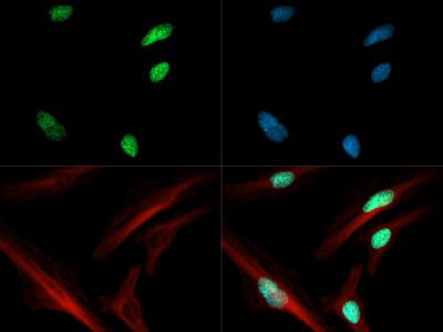 H3K4ac Antibody in Immunocytochemistry (ICC/IF)