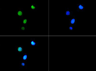 H3K9me3T6ph Antibody in Immunocytochemistry (ICC/IF)