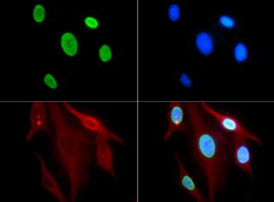 H3K9ac Antibody in Immunocytochemistry (ICC/IF)