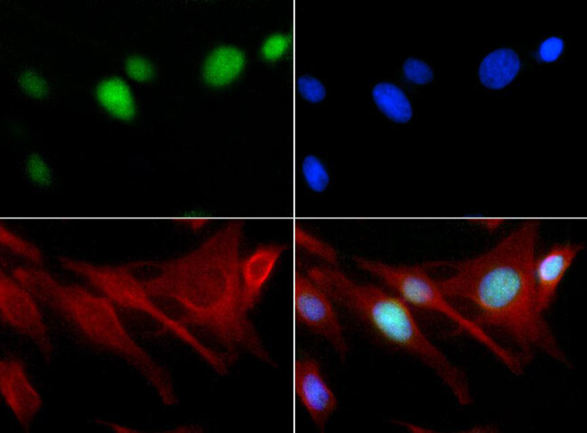 H3K18me1 Antibody in Immunocytochemistry (ICC/IF)