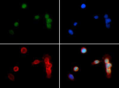 H3K18me2 Antibody in Immunocytochemistry (ICC/IF)