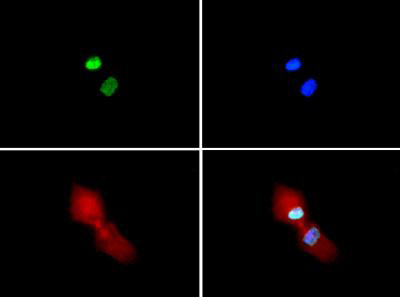 H3R2me2sK4me2 Antibody in Immunocytochemistry (ICC/IF)