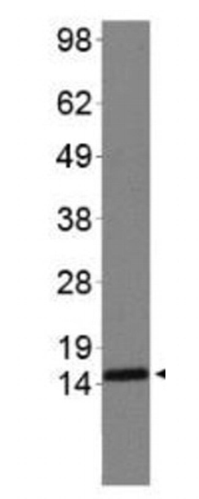 H3R2me2sK4me2 Antibody in Western Blot (WB)