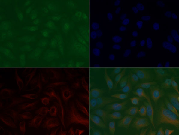 H3K37me3 Antibody in Immunocytochemistry (ICC/IF)