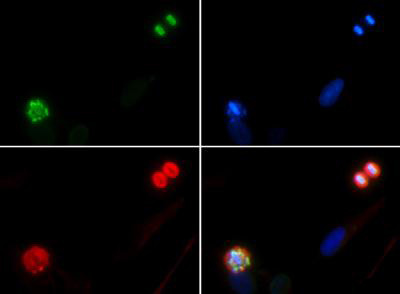 Phospho-Histone H10 (Ser1) Antibody in Immunocytochemistry (ICC/IF)