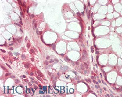 HDAC5 (internal) Antibody in Immunohistochemistry (Paraffin) (IHC (P))