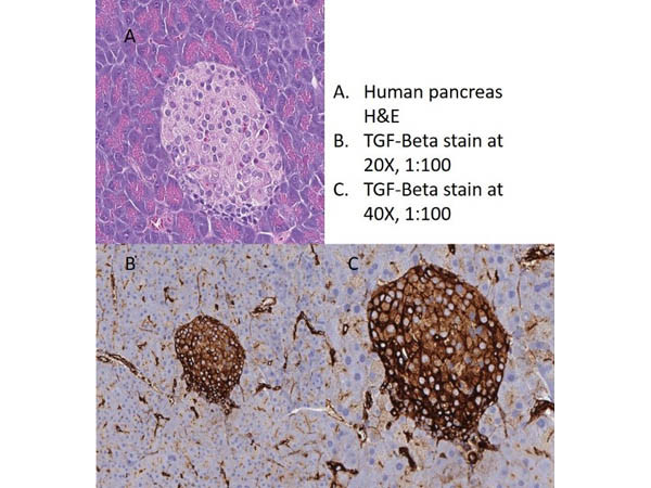 TGF beta Receptor 1 Antibody in Immunohistochemistry (IHC)