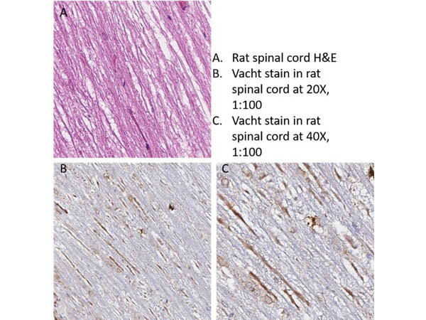 VAChT Antibody in Immunohistochemistry (IHC)