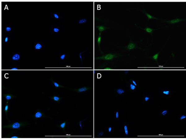 Foxp3 Antibody in Immunocytochemistry (ICC/IF)