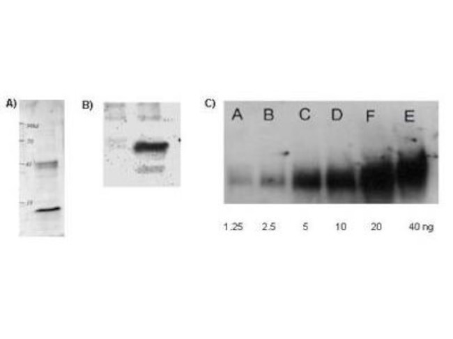 Lysine Acetylated Antibody in Western Blot (WB)